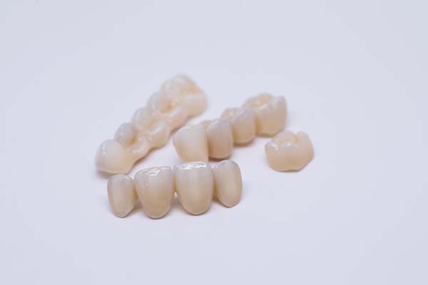 Can A Dental Bridge Help With Teeth Alignment?