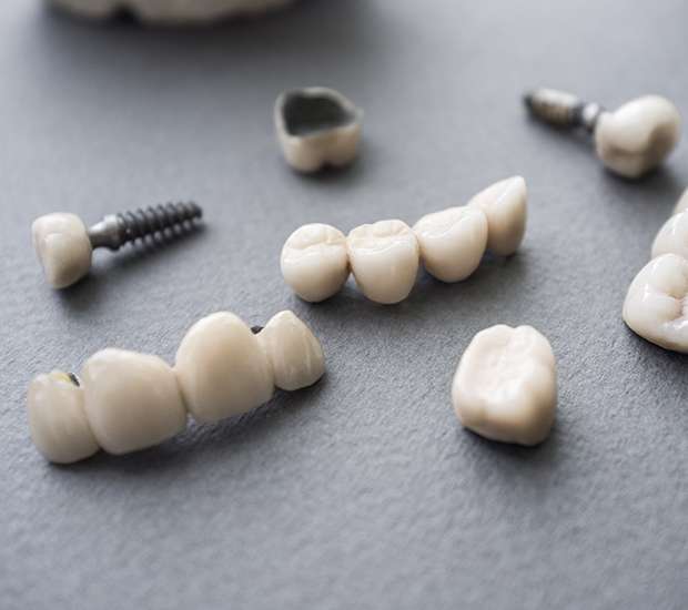 Union City The Difference Between Dental Implants and Mini Dental Implants